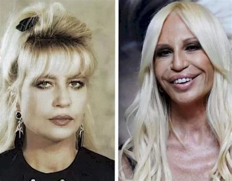 versace skull face|donatella versace face what happened.